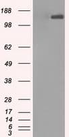Monoclonal Mouse anti-Human L1CAM Antibody (clone OTI4F4, IHC, IF, WB)