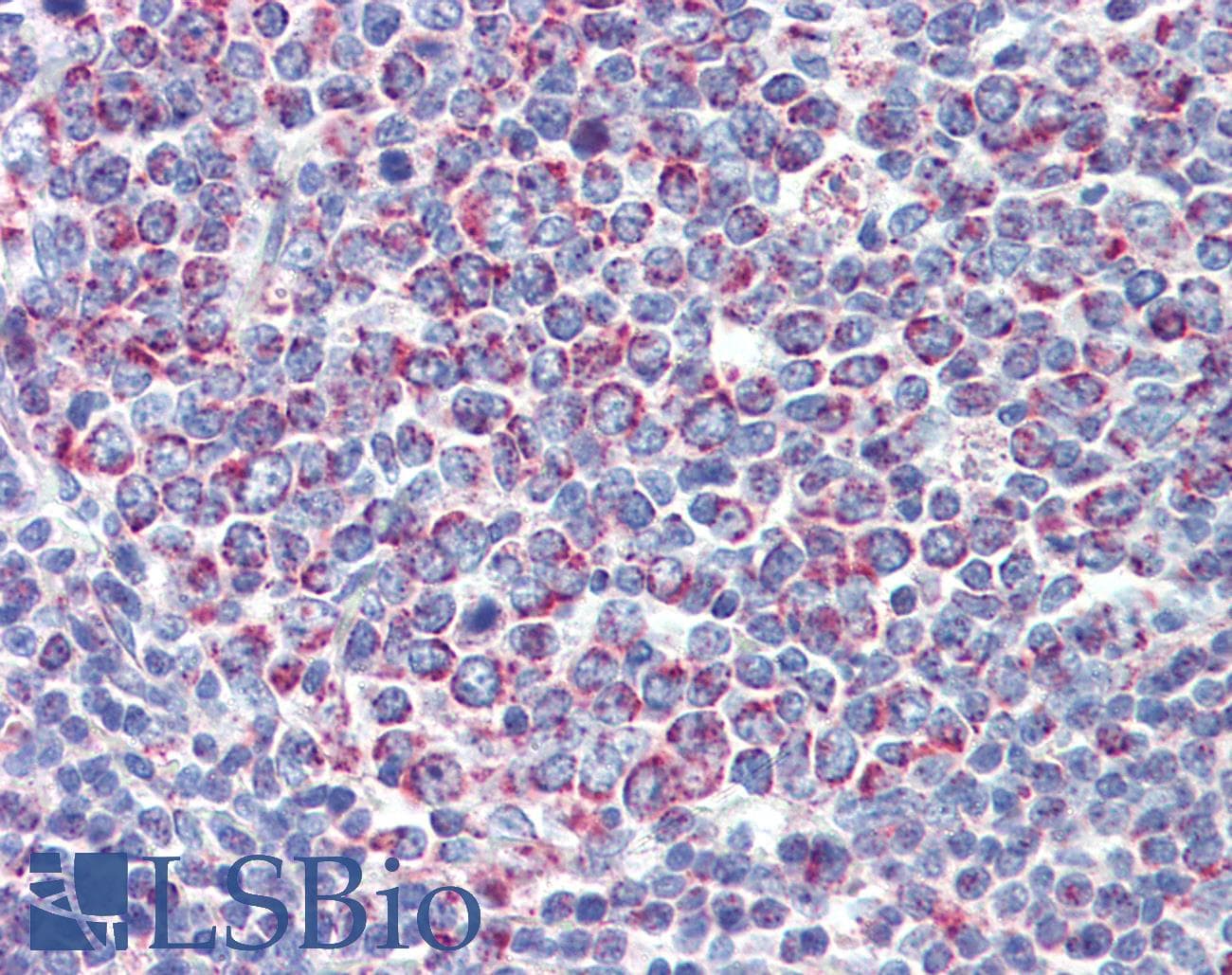 PGLS / 6PGL Antibody (C-Terminus)