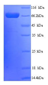 Human PTPRN2 / Phogrin Protein (Recombinant His)