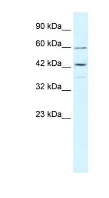 TRIM68 Antibody (aa279-328, HRP)