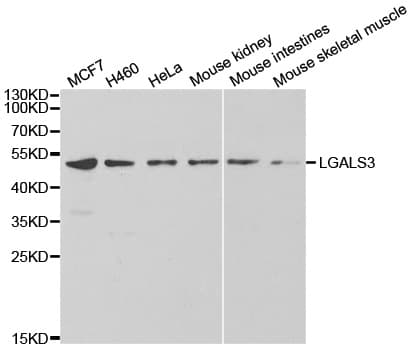 IHC-plus™ LGALS3 / Galectin 3 Antibody