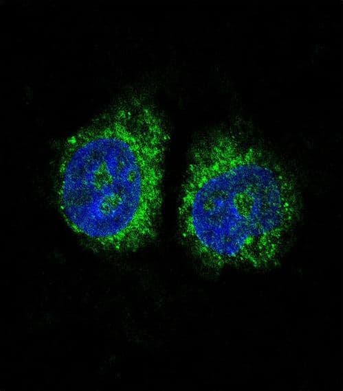 Polyclonal Rabbit anti-Human NR4A2 / NURR1 Antibody (aa13-42, IHC, IF, WB)