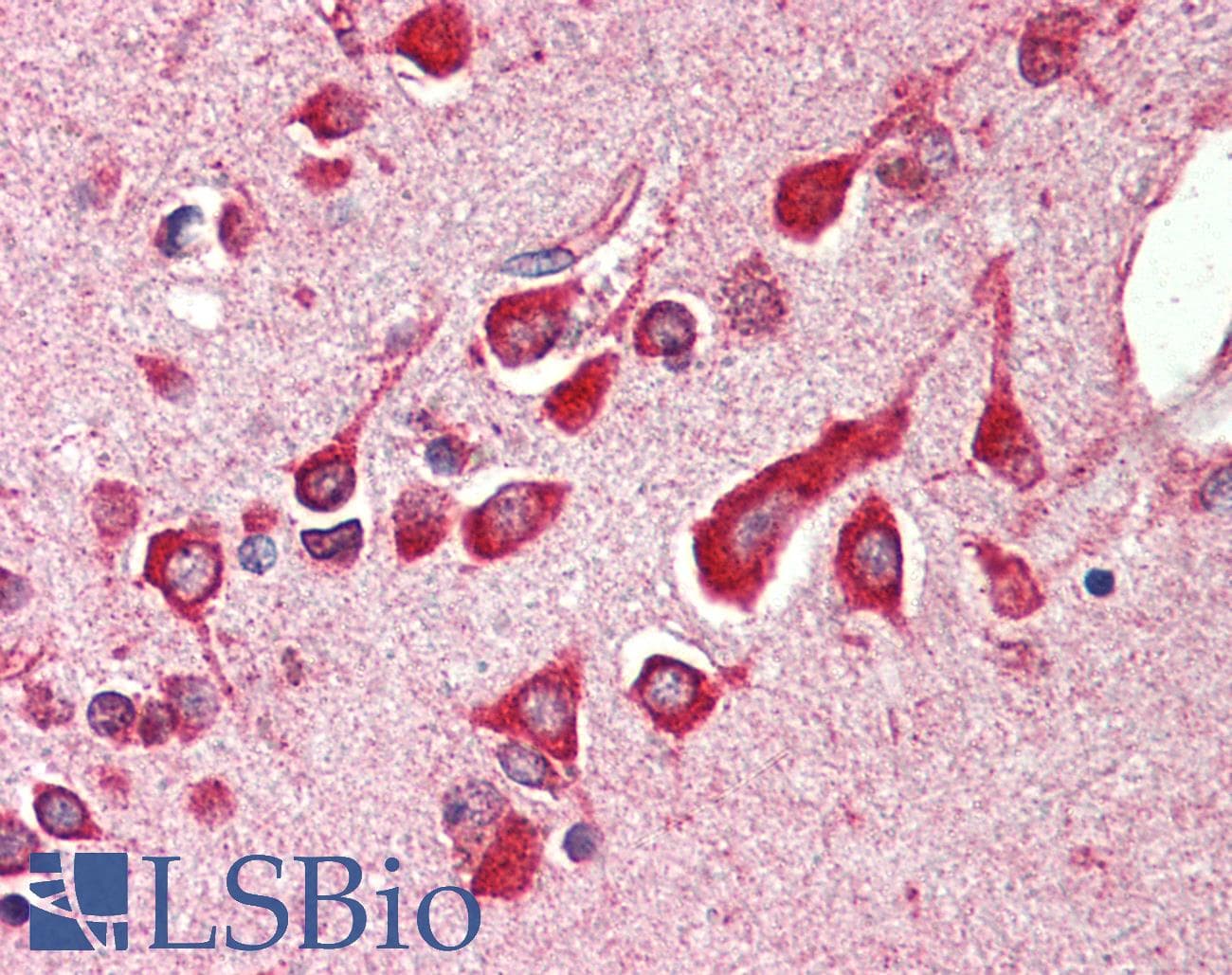 IHC-plus™ Polyclonal Rabbit anti-Human BAP29 / BCAP29 Antibody (IHC, IF, WB)