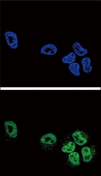 PLA2G4A Antibody (aa513-541)