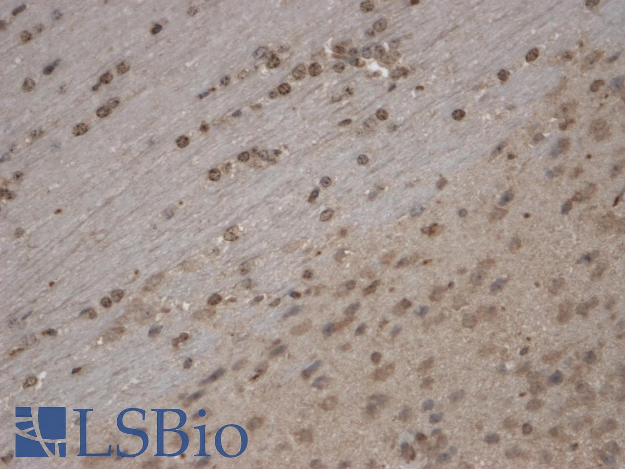 TRPC5 Antibody (aa827-845, clone S67-15, AP)