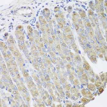 Osteocalcin Antibody (AP)