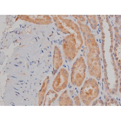 Polyclonal Rabbit anti-Human SP1 Antibody (phospho-Thr739, IHC, IF, WB)
