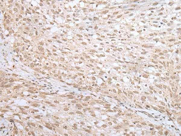 Polyclonal Rabbit anti-Human MORF4L1 / MRG15 Antibody (IHC)