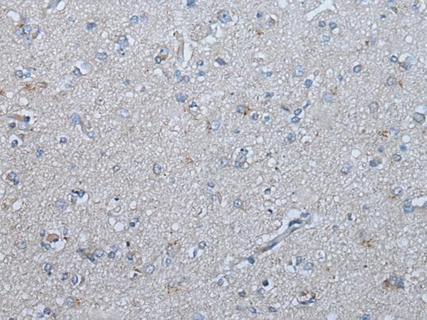 Polyclonal Rabbit anti-Human UBR4 Antibody (IHC)