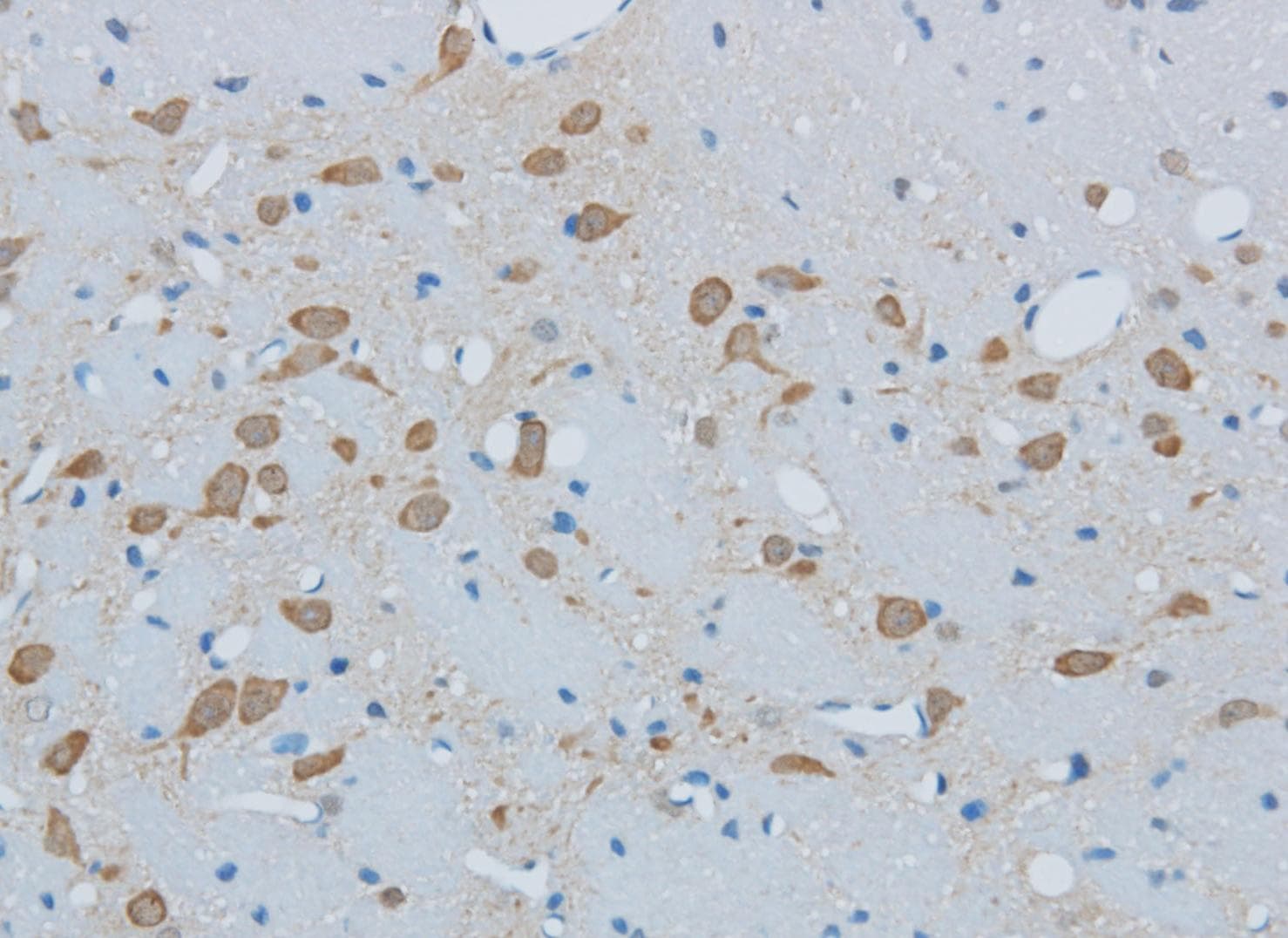 Polyclonal Rabbit anti-Human TIMP4 Antibody (IHC)