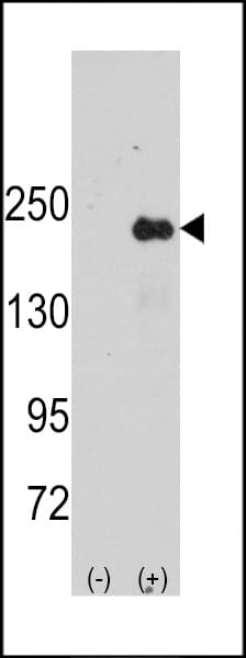 SPAG9 Antibody (aa603-632)