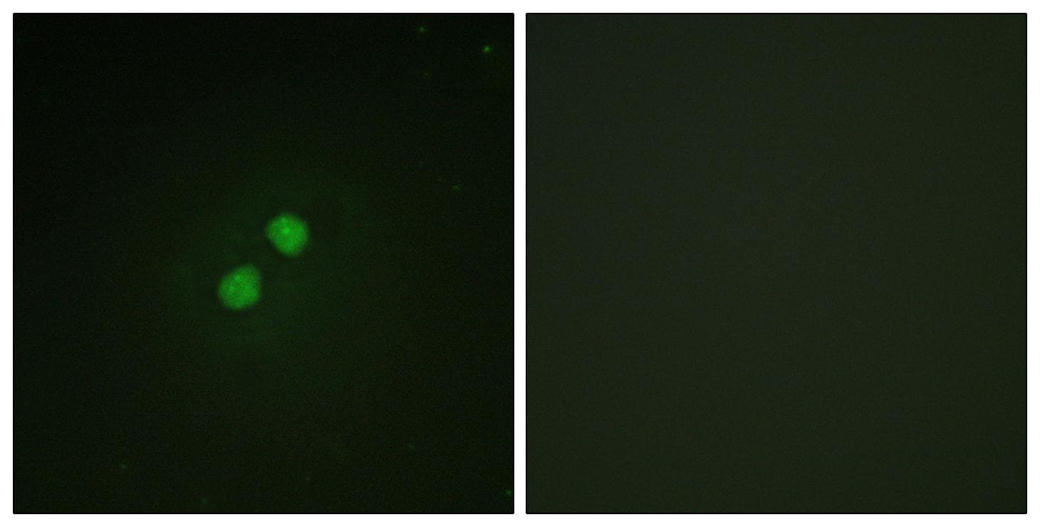 NBN / Nibrin Antibody (phospho-Ser278)