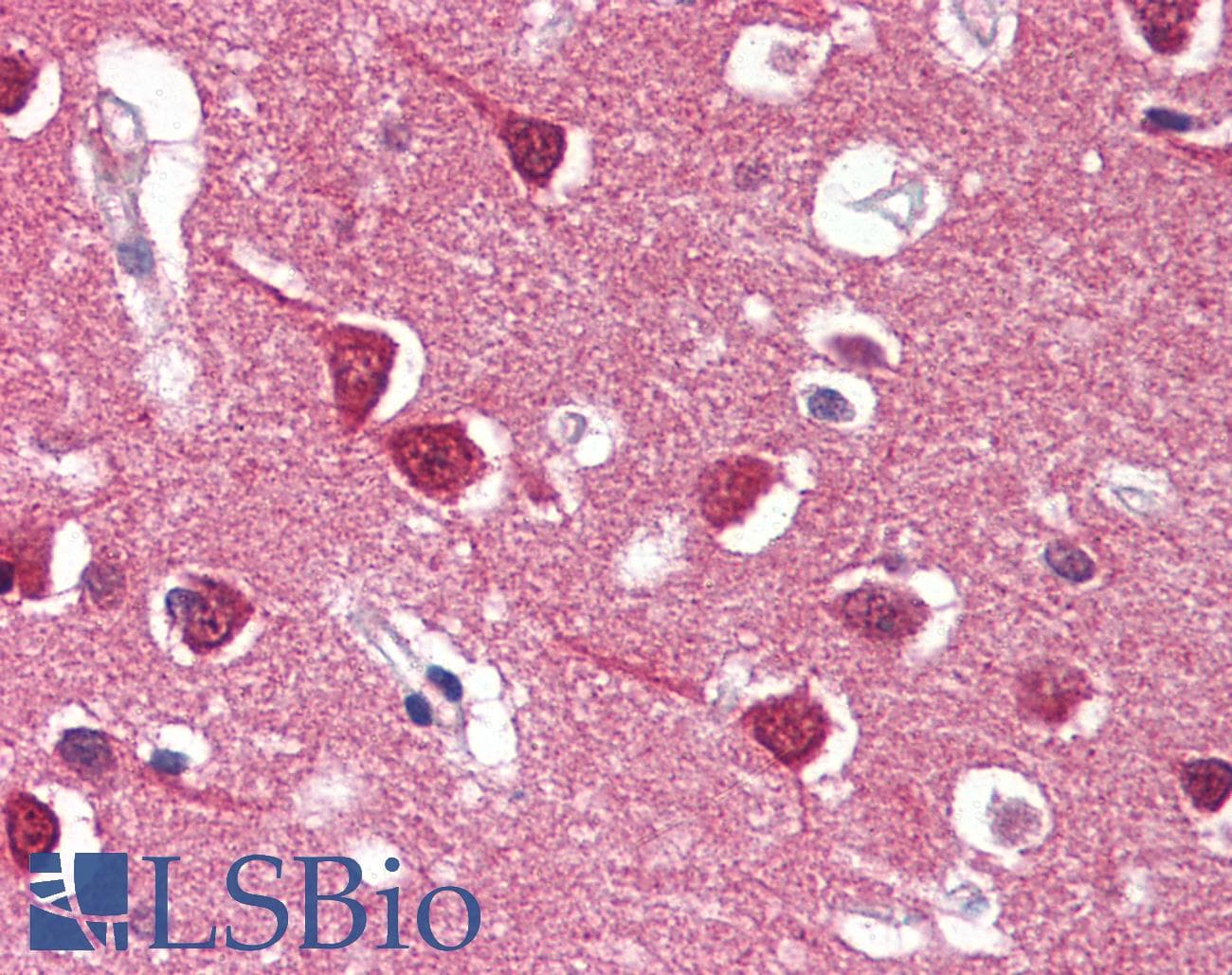 IHC-plus™ REXO1 / REX1 Antibody (aa1060-1221, clone 4H5)