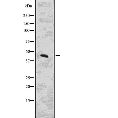 CYTH3 / GRP1 Antibody