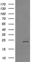 Monoclonal Mouse anti-Human TCL / RHOJ Antibody (clone OTI2C10, IHC, IF, WB)