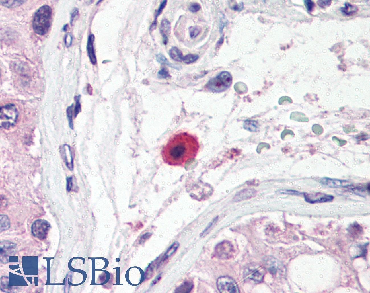 IHC-plus™ TNFRSF13B / TACI Antibody