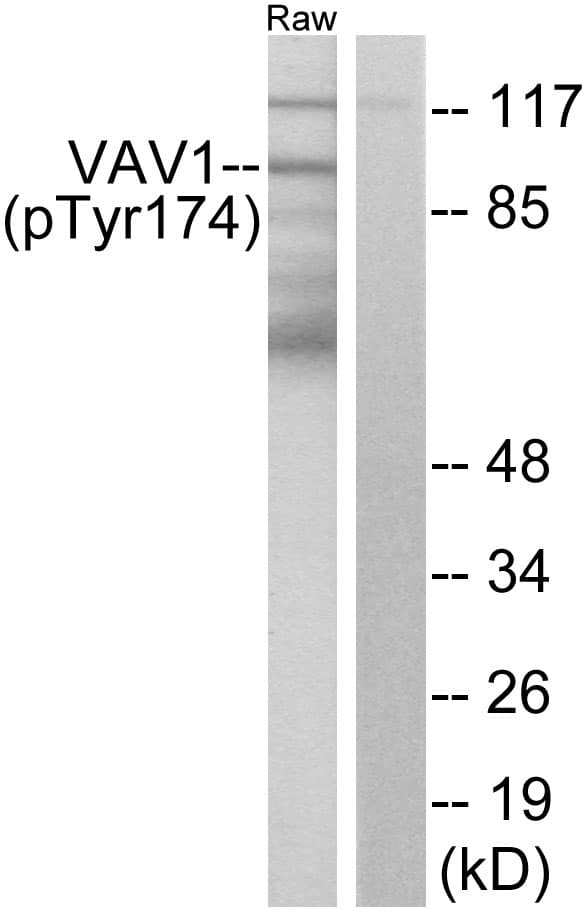 Polyclonal Rabbit anti-Human VAV1 / VAV Antibody (phospho-Tyr174, WB)