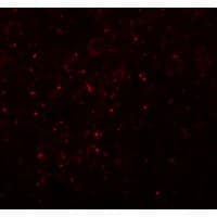 IHC-plus™ CCDC141 Antibody