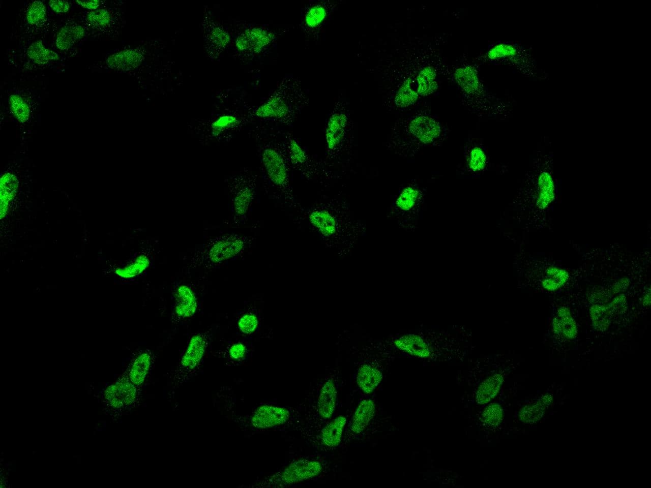TRIM33 / TIF1-Gamma Antibody