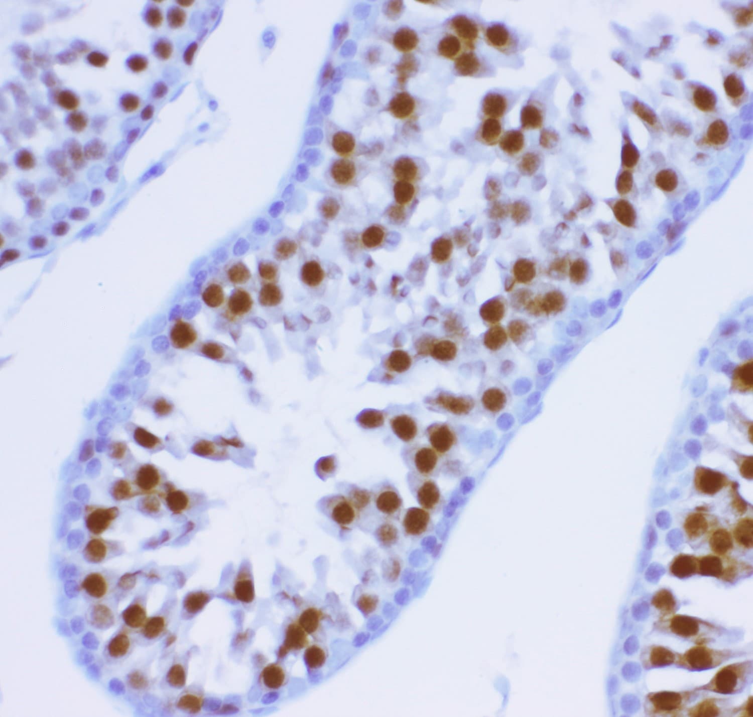 KIF2C / MCAK Antibody (aa531-725)