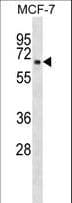 TMEM5 Antibody (aa55-82)