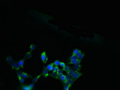 Polyclonal Rabbit anti-Human SLC13A4 Antibody (IHC, WB)