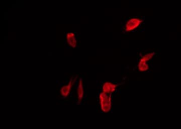 IRS1 Antibody (phospho-Ser307)