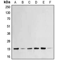 BAX Antibody (N-Terminus)