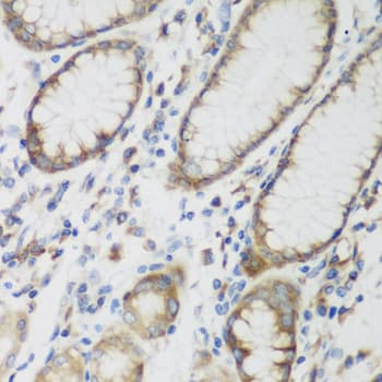 SHBG Antibody