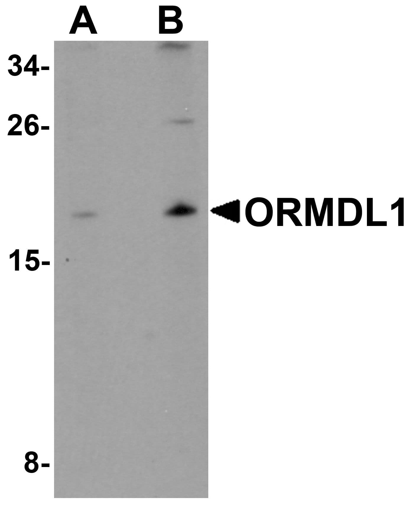 IHC-plus™ Polyclonal Rabbit anti-Human ORMDL1 Antibody (IHC, IF, WB)