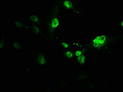 PVALB / Parvalbumin Antibody (aa2-110)