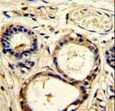 Polyclonal Rabbit anti-Human CTTN / Cortactin Antibody (aa9-38, IHC, WB)