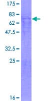 Human BCL6B Protein (Recombinant GST)