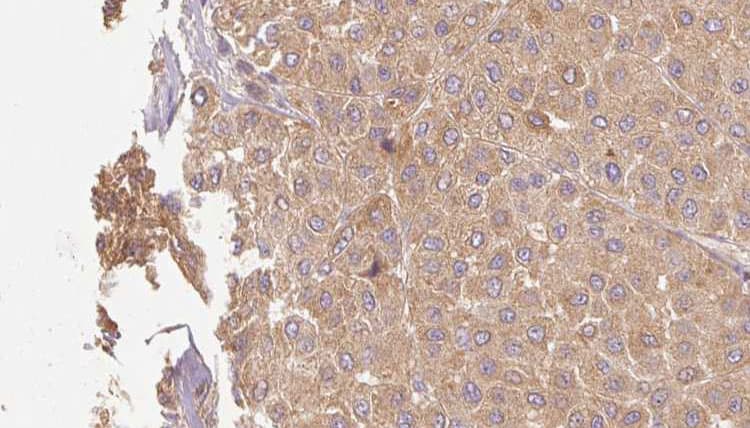 Polyclonal Rabbit anti-Human GZMM / Granzyme M Antibody (IHC, WB)