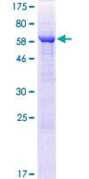 Human ARFIP1 Protein (Recombinant GST)