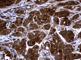 NME1 / NM23 Antibody (clone OTI2A5)