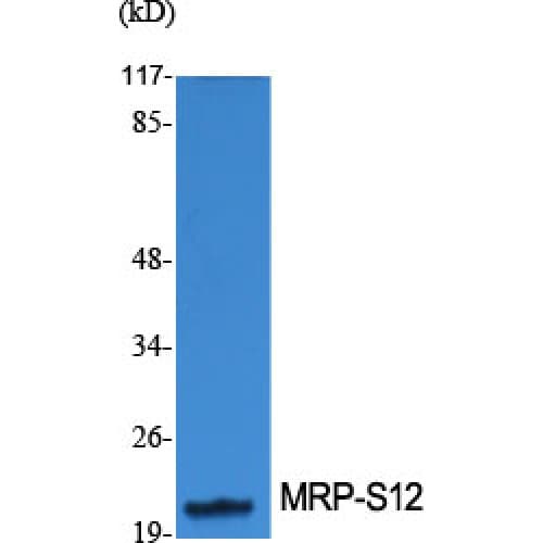 MRPS12 / RPSM12 Antibody (40-120 aa, Internal)
