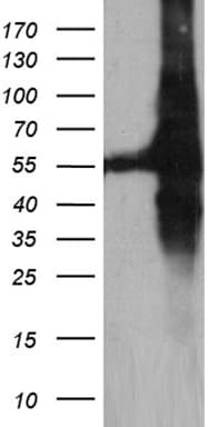 GDI1 Antibody (clone OTI8A3)