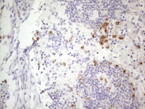 APOBR / APOB48R Antibody (aa780-1088, clone OTI1B5)