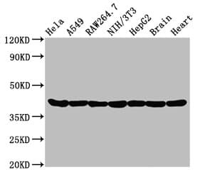 ACTA1 / Skeletal Muscle Actin Antibody
