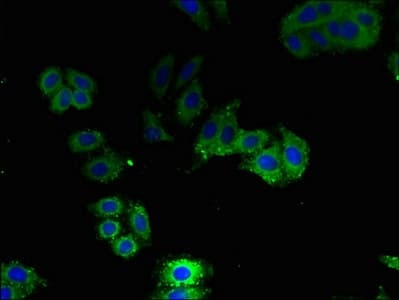 IHC-plus™ AQP1 / Aquaporin 1 Antibody