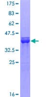 Human SOX9 Protein (Recombinant GST, N-terminus)