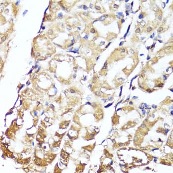 GKN1 / Gastrokine 1 Antibody