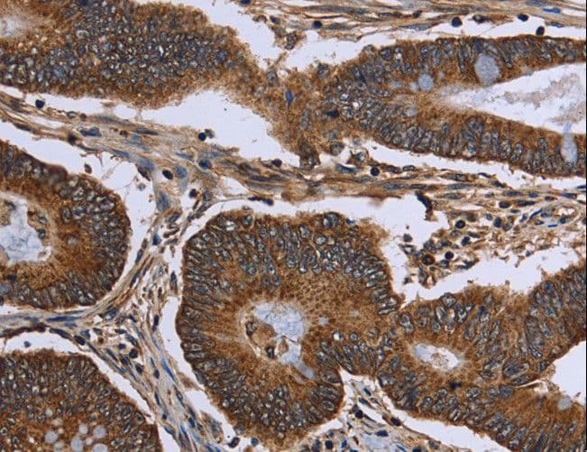FHIT Antibody