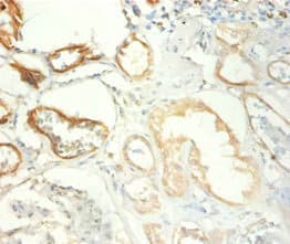 Polyclonal Rabbit anti-Human TRIM28 / KAP1 Antibody (IHC, WB)
