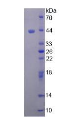 Human ACTG1 / Gamma Actin Protein (Recombinant His)