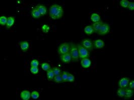 Monoclonal Mouse anti-Human ACAT2 Antibody (clone OTI1G6, IHC, IF, WB)