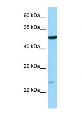 RAB9B Antibody (aa58-107)