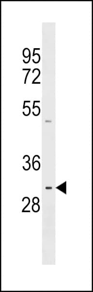 Polyclonal Rabbit anti-Human PRR23A Antibody (aa21-47, WB)