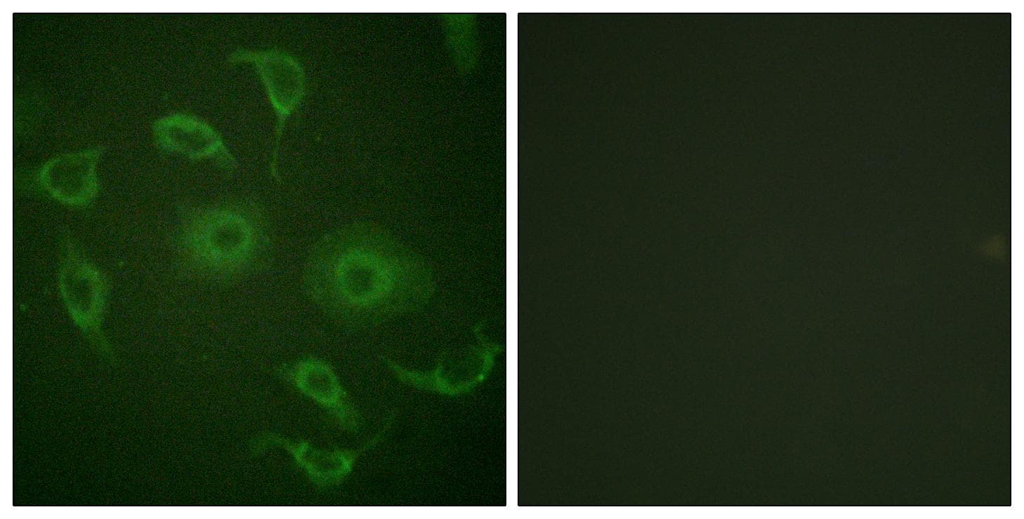 IFNAR1 / IFNAR Antibody